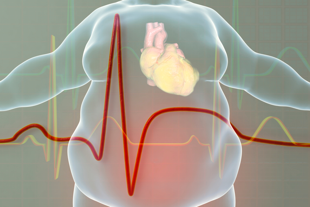 Preventive Cardiology